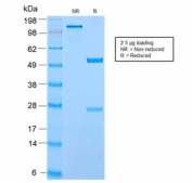 SDS-PAGE analysis of purified, BSA-free recombinant ECM1 antibody (clone ECM1/2889R) as confirmation of integrity and purity.