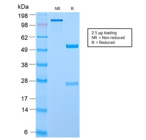 SDS-PAGE analysis of purified, BSA-free recombinant EC