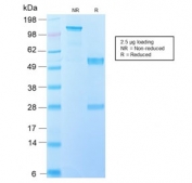 SDS-PAGE analysis of purified, BSA-free recombinant EGFRvIII antibody (clone GFR/2600R) as confirmation of integrity and purity.