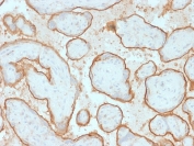 IHC testing of FFPE human placenta with recombinant EGFRvIII antibody (clone GFR/2600R). Required HIER: boiling tissue sections in pH 9 10mM Tris with 1mM EDTA for 10-20 min and allow to cool prior to testing.