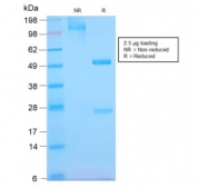 SDS-PAGE analysis of purified, BSA-free recombinant EGF Receptor antibody (clone GFR/2968R) as confirmation of integrity and purity.