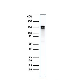 Western blot testing of human A431 cell lysate with recombinant EGF Receptor antibody. Expected molecular weight: 134-180 kDa depending on glycosylation level.~