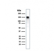 Western blot testing of human A431 cell lysate with recombinant EGF Receptor antibody. Expected molecular weight: 134-180 kDa depending on glycosylation level.