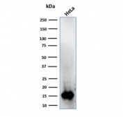Western blot testing of human HeLa cell lysate with FABP5 antibody. Predicted molecular weight ~15 kDa.