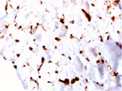 IHC testing of FFPE human skeletal muscle with FABP5 antibody. HIER: boiling tissue sections in pH 9 10mM Tris with 1mM EDTA for 10-20 min and allow to cool prior to staining.