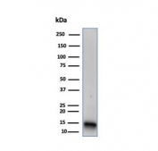 Western blot testing of human Raji cell lysate with FABP5 antibody. Predicted molecular weight ~15 kDa.