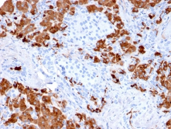 IHC testing of FFPE human pancreas with Carboxypeptidase A1 antibody (clone CPA1/2712). HIER: boil tissue sections in pH6, 10mM citrate buffer, for 10-20 min followed by cooling at RT for 20 min.~