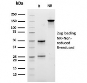 SDS-PAGE analysis of purified, BSA-free Carboxypeptidase A1 antibody (clone CPA1/2712) as confirmation of integrity and purity.