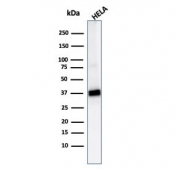 Western blot testing of human HeLa cell lysate with AKR1B1 antibody (clone CPTC-AKR1B1-2). Predicted molecular weight ~36 kDa.