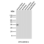 AKR1B1 Antibody Cross-Species WB. Western blot analysis of human, mouse, rat, hamster, guinea pig, and rabbit kidney tissue lysates using AKR1B1 Antibody clone CPTC-AKR1B1-2. A distinct band is detected near approximately 35-40 kDa in human kidney tissue, consistent with the predicted molecular weight of Aldose reductase / AKR1B1, an oxidative stress-associated aldo-keto reductase family enzyme involved in reactive aldehyde detoxification, glucose-responsive signaling, and cellular redox regulatory pathways. Minimal signal is observed in the additional species tested under these experimental conditions.