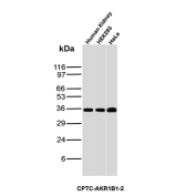 AKR1B1 Antibody Tissue and Cell Line WB. Western blot analysis of human kidney tissue together with HEK293 and HeLa cell lysates using AKR1B1 Antibody clone CPTC-AKR1B1-2. Strong bands are detected near approximately 35-40 kDa across all samples, consistent with the predicted molecular weight of Aldose reductase / AKR1B1, an oxidative stress-associated aldo-keto reductase family enzyme involved in reactive aldehyde detoxification, glucose-responsive signaling, and cellular redox regulatory pathways.