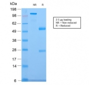 SDS-PAGE analysis of purified, BSA-free recombinant CELA3B antibody (clone CELA3B/2809R) as confirmation of integrity and purity.