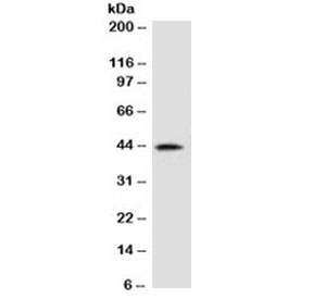 Western blot testing of human kidney lysate with AMACR antibody (clone 2MACR-1). Predicted molecular weight ~43 kDa.~