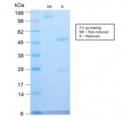SDS-PAGE analysis of purified, BSA-free ATRX antibody (clone ATMRX-1R) as confirmation of integrity and purity.
