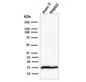 Western blot testing of Fascin antibody and human 1) Panc-2 and 2) HepG2 cell lysate (clone FXN/2124). Expected molecular weight: ~23 kDa (full length), ~14 kDa (mature).