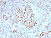 IHC testing of FFPE human pancreas with FXN antibody (clone FXN/2124). Required HIER: boil tissue sections in pH 9 10mM Tris with 1mM EDTA for 10-20 min and allow to cool before testing.