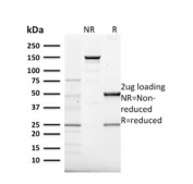 SDS-PAGE analysis of purified, BSA-free FXN antibody (clone FXN/2124) as confirmation of integrity and purity.