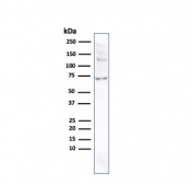 Western blot testing of human JEG-3 cells with recombinant Placental Alkaline Phosphatase antibody (clone ALPP/2899R). Predicted molecular weight ~58 kDa but routinely visualized at 60-70 kDa.