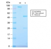SDS-PAGE analysis of purified, BSA-free recombinant Placental Alkaline Phosphatase antibody (clone ALPP/2899R) as confirmation of integrity and purity.