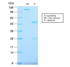 SDS-PAGE analysis of purified, BSA-free recombinant Placental Alkaline Phosphatase antibody (clone ALPP/2899R) as confirmati