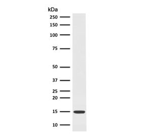 Western blot testing of Fascin antibody and human HepG2 cell lysate (clone FDAX-1). Expected molecular weight: ~23 kDa (full length), ~14 kDa (mature).~