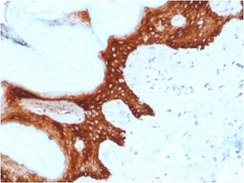 IHC staining of FFPE human skin with 14-3-3 Sigma antibody (clone CPTC-SFN-2). HIER: boil tissue sections in pH6, 10mM citrate buffer, for 10-20 min followed by cooling at RT for 20 min.~
