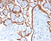 IHC staining of FFPE human placental tissue with HCG-beta antibody (clone HCGb/7201R). Negative control inset: PBS used instead of primary antibody to control for secondary Ab binding.