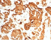 IHC staining of FFPE human pituitary gland tissue with HCG-beta antibody (clone HCGb/7201R). HIER: boil tissue sections in pH 9 10mM Tris with 1mM EDTA for 20 min and allow to cool before testing.