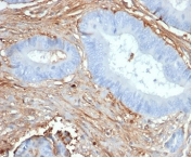 IHC staining of FFPE human prostate tissue with Fibrillin 1 antibody (clone FBN1/6933). HIER: boil tissue sections in pH 9 10mM Tris with 1mM EDTA for 20 min and allow to cool before testing.