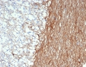 IHC staining of FFPE human cerebellum tissue with GFAP antibody (clone GFAP/6884). HIER: boil tissue sections in pH 9 10mM Tris with 1mM EDTA for 20 min and allow to cool before testing.
