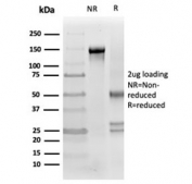 SDS-PAGE analysis of purified, BSA-free Clusterin antibody (clone CLU/4721) as confirmation of integrity and purity.