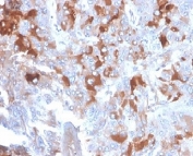 IHC staining of FFPE human adrenal gland tissue with Clusterin antibody (clone CLU/4721). HIER: boil tissue sections in pH 9 10mM Tris with 1mM EDTA for 20 min and allow to cool before testing.