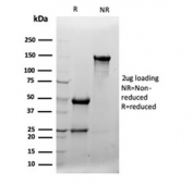 SDS-PAGE analysis of purified, BSA-free Clusterin antibody (clone CLU/4724) as confirmation of integrity and purity.