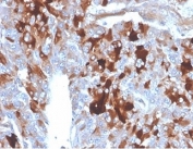 IHC staining of FFPE human adrenal gland tissue with Clusterin antibody (clone CLU/4724). HIER: boil tissue sections in pH 9 10mM Tris with 1mM EDTA for 20 min and allow to cool before testing.