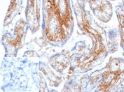 IHC staining of FFPE human placental tissue with Decorin antibody (clone DCN/6289) at 2ug/ml. Negative control inset: PBS used instead of primary antibody to control for secondary Ab binding.