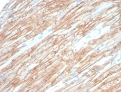 IHC staining of FFPE human heart tissue with DMD antibody (clone DMD/6270). HIER: boil tissue sections in pH 9 10mM Tris with 1mM EDTA for 20 min and allow to cool before testing.