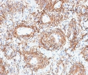 IHC staining of FFPE human kidney tissue with FBN1 antibody (clone FBN1/2191). HIER: boil tissue sections in pH 9 10mM Tris with 1mM EDTA for 20 min and allow to cool before testing.