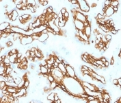 IHC staining of FFPE human placental tissue with FBN1 antibody (clone FBN1/2191). HIER: boil tissue sections in pH 9 10mM Tris with 1mM EDTA for 20 min and allow to cool before testing.