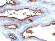 IHC staining of FFPE human prostate tissue with CD13 antibody (clone APN/6997). HIER: boil tissue sections in pH 9 10mM Tris with 1mM EDTA for 20 min and allow to cool before testing.