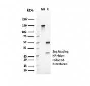 SDS-PAGE analysis of purified, BSA-free CD23 antibody (clone FCER2/6888) as confirmation of integrity and purity.