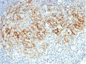 IHC staining of FFPE human lymph node tissue with CD23 antibody (clone FCER2/6888). HIER: boil tissue sections in pH 9 10mM Tris with 1mM EDTA for 20 min and allow to cool before testing.