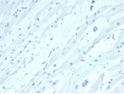 Negative control: IHC staining of FFPE human heart tissue with SATB2 antibody (clone SATB2/7111). HIER: boil tissue sections in pH 9 10mM Tris with 1mM EDTA for 20 min and allow to cool before testing.