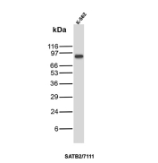 SATB2 Antibody K-562 WB. Western blot analysis of K-562 cell lysate using SATB2 Mouse Monoclonal Antibody clone SATB2/7111. A distinct band is detected at approximately 85 kDa, consistent with the expected molecular weight of Special AT-rich sequence-binding protein 2 / SATB2, a chromatin-associated transcriptional regulator involved in epigenetic organization and lineage-specific gene expression pathways.