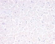 Negative control: IHC analysis of FFPE human heart tissue using GFAP antibody (clone GFAP/6880). HIER: boil tissue sections in pH 9 10mM Tris with 1mM EDTA for 20 min and allow to cool before testing.
