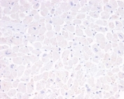 Negative control: IHC analysis of FFPE human heart tissue using GFAP antibody (clone GFAP/6880). HIER: boil tissue sections in pH 9 10mM Tris with 1mM EDTA for 20 min and allow to cool before testing.