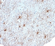 IHC staining of FFPE human cerebral cortex tissue with GFAP antibody (clone GFAP/6880). HIER: boil tissue sections in pH 9 10mM Tris with 1mM EDTA for 20 min and allow to cool before testing.