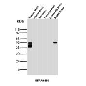 GFAP Antibody Brain Tissue WB. Western blot analysis of human brain, mouse brain, rat brain, hamster brain, guinea pig brain, and rabbit brain tissue lysates using GFAP Antibody clone GFAP/6880. Distinct bands are detected at approximately 50 kDa in human and rabbit brain lysates, consistent with the predicted molecular weight of Glial fibrillary acidic protein / GFAP, a major astrocytic intermediate filament protein involved in maintenance of neural cytoskeletal architecture. Multiple closely migrating lower molecular weight bands observed in the human brain sample likely represent GFAP isoforms and/or partial proteolytic processing products commonly encountered in brain tissue lysates.