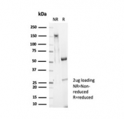 SDS-PAGE analysis of purified, BSA-free Glypican 3 antibody (clone GPC3/7107) as confirmation of integrity and purity.