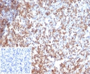IHC staining of FFPE human tonsil tissue with recombinant CD2 antibody (clone rLFA2/7147). Negative control inset: PBS used instead of primary antibody to control for secondary Ab binding. HIER: boil tissue sections in pH 9 10mM Tris with 1mM EDTA for 20 min and allow to cool before testing.