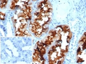 IHC staining of FFPE human kidney with CD13 antibody (clone APN/6998). Negative control inset: PBS used instead of primary antibody to control for secondary Ab binding. HIER: boil tissue sections in pH 9 10mM Tris with 1mM EDTA for 20 min and allow to cool before testing.